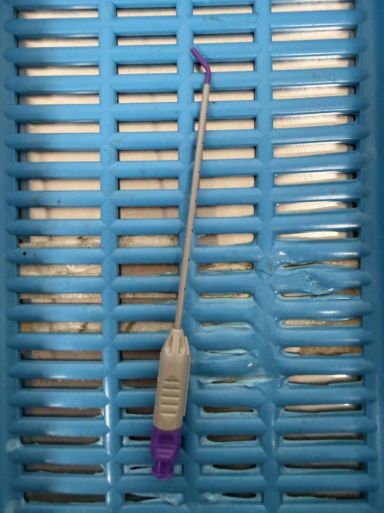 Soft curved-tip directional catheter used to deliver topical anesthetic to the sphenopalatine ganglion through the nostril, with no needle