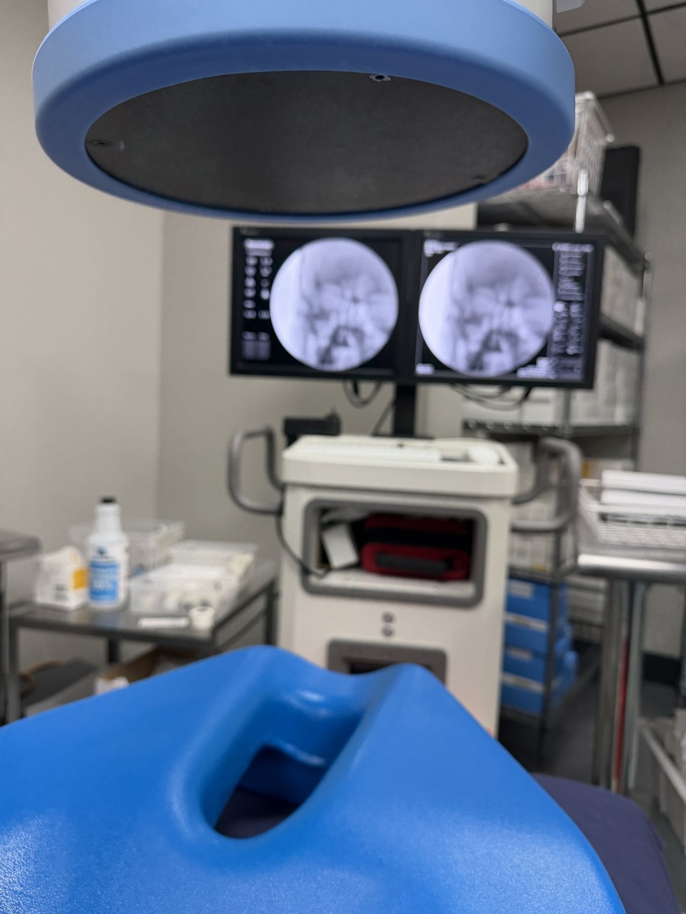 Procedure room at the Headache Express clinic with C-arm fluoroscopy monitors displaying skull views, set up for a trigeminal branch block